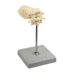 ATLAS AND AXIS, WITH OCCIPITAL PLATE