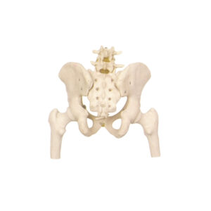 PELVIC SKELETON, FEMALE, WITH FEMUR HEADS