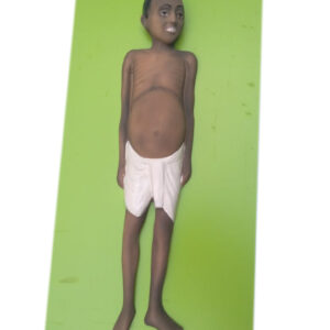 KALA AZAR