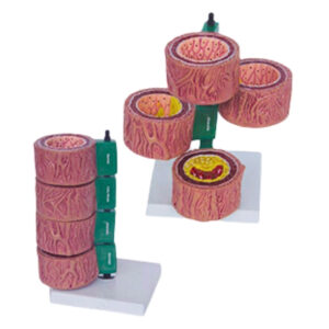 ARTERY (NORMAL, FATTY STREAK, ATHEROMA AND FIBROUS PLAQUE AND BLOCKAGE)